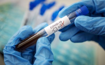 В Україні розглянуть можливість бустерної дози для всіх охочих